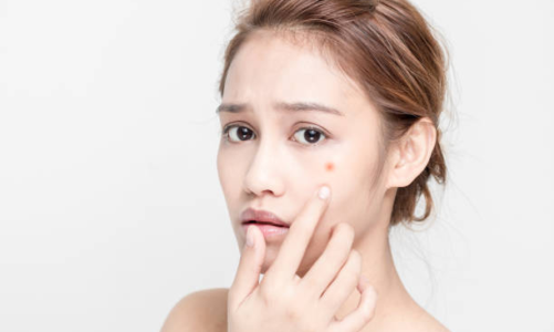Isotretinoin: Uses, Side Effects, Precaution & More